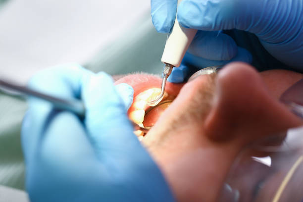 Best Emergency Treatment for Toothache in Eatonville, WA