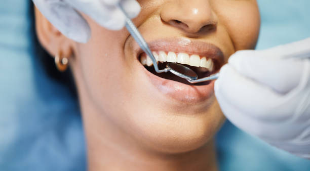 Best Same-Day Emergency Dentist in Eatonville, WA