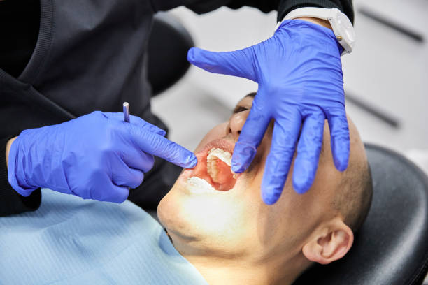 Best Emergency Broken Tooth Repair in Eatonville, WA