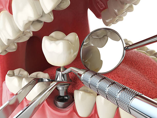 Best Weekend Emergency Dentist in Eatonville, WA